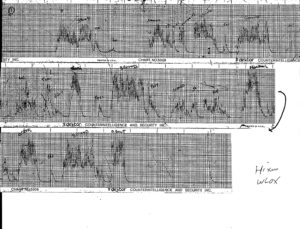 Polygraph Test of Charles Hickson-1