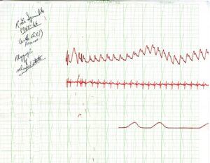 Polygraph Chart - 1