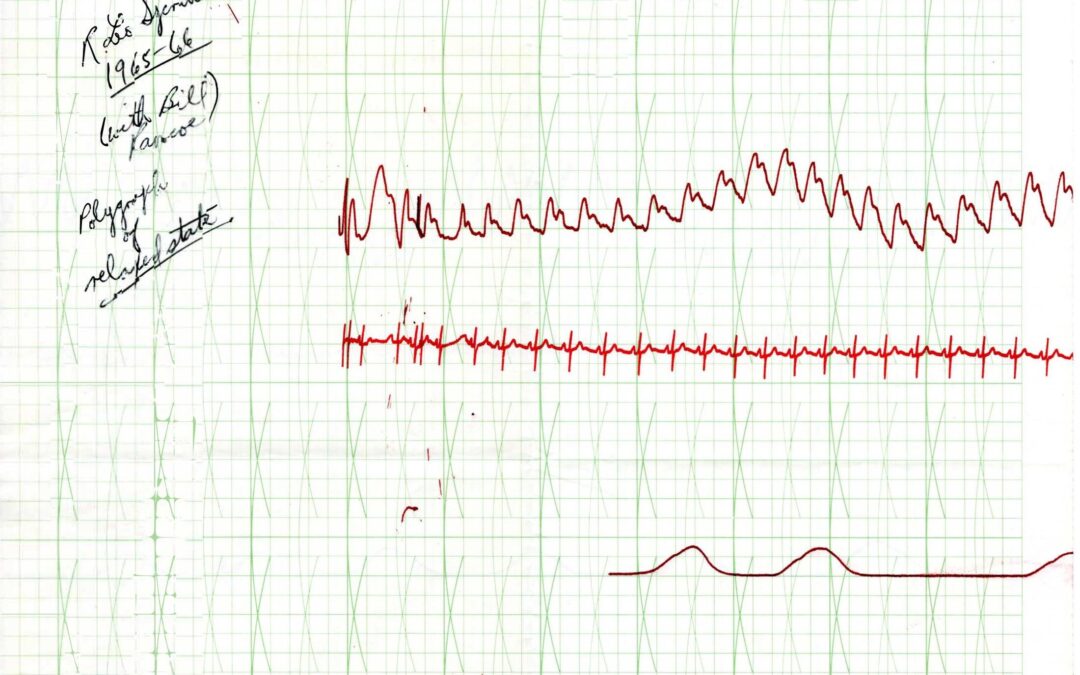 Polygraph Chart – 1